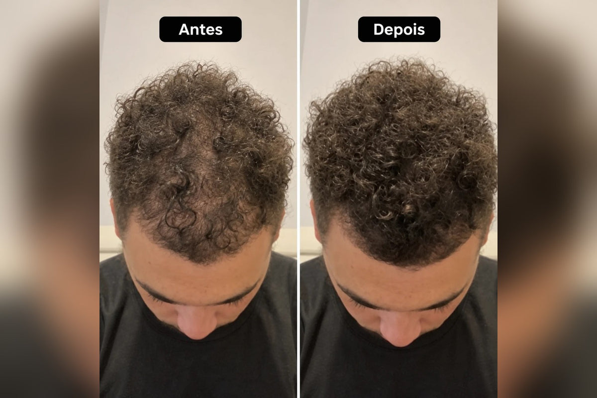 Antes e depois